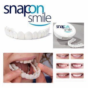 Знімні вініри для зубів Snap On Smile на 2 щелепи &bull; Накладні вініри на верхню та нижню щелепу для красивої усмішки 57530 фото