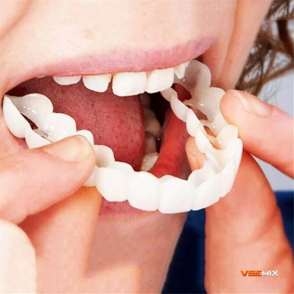 Знімні вініри для зубів Snap On Smile на 2 щелепи &bull; Накладні вініри на верхню та нижню щелепу для красивої усмішки 57530 фото